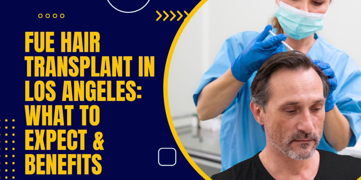 FUE Hair Transplant in Los Angeles: What to Expect & Benefits