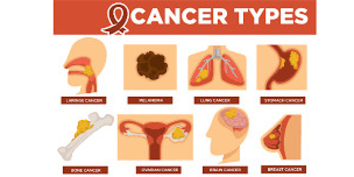A Comprehensive Guide to Common Cancer Types