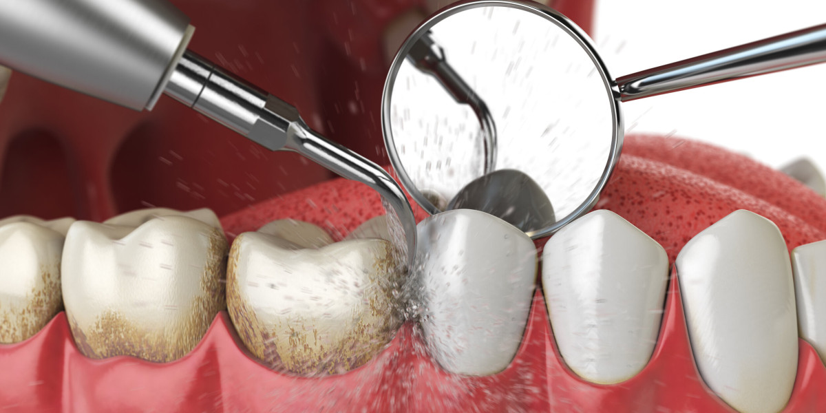 Can I use mouthwash after deep cleaning?