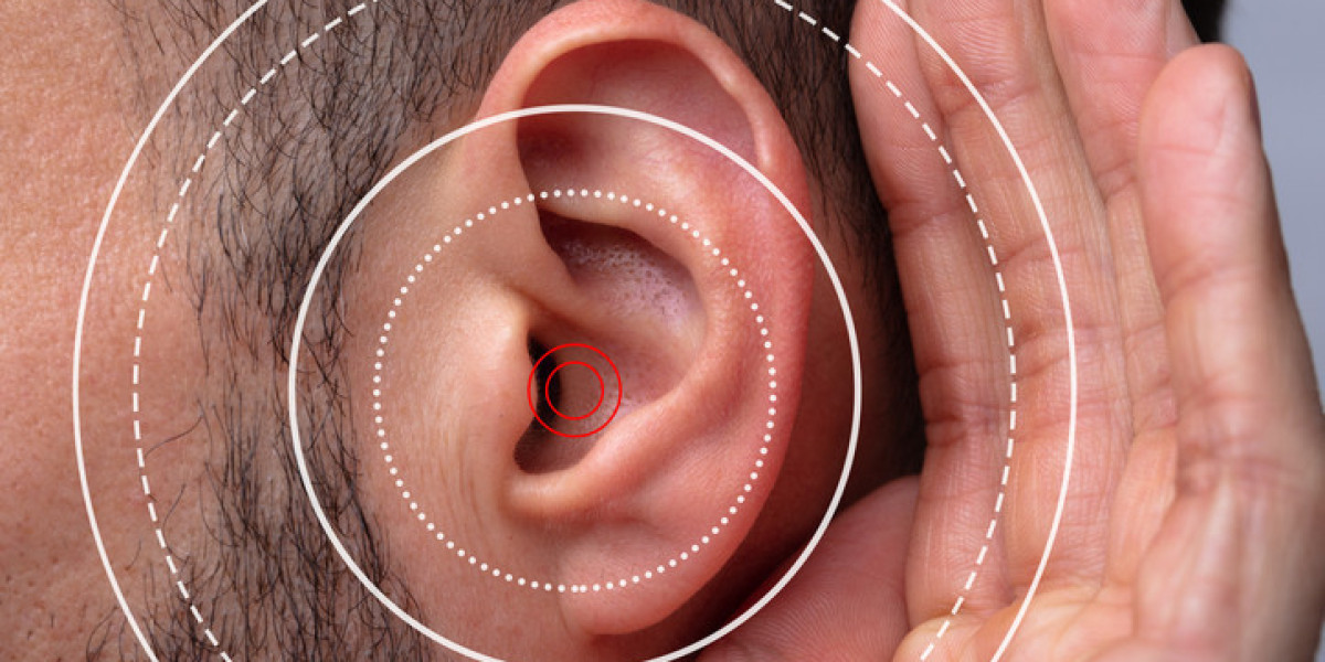 Audifort USA, CA, UK, AU, NZ, IE: Why This Natural Tinnitus Supplement Is Trusted Worldwide?