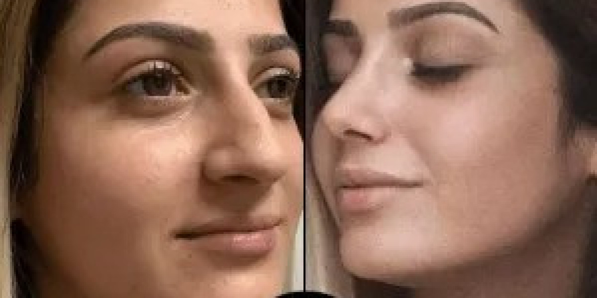 Best Aesthetic Clinics in Dubai for Natural-Looking Enhancements
