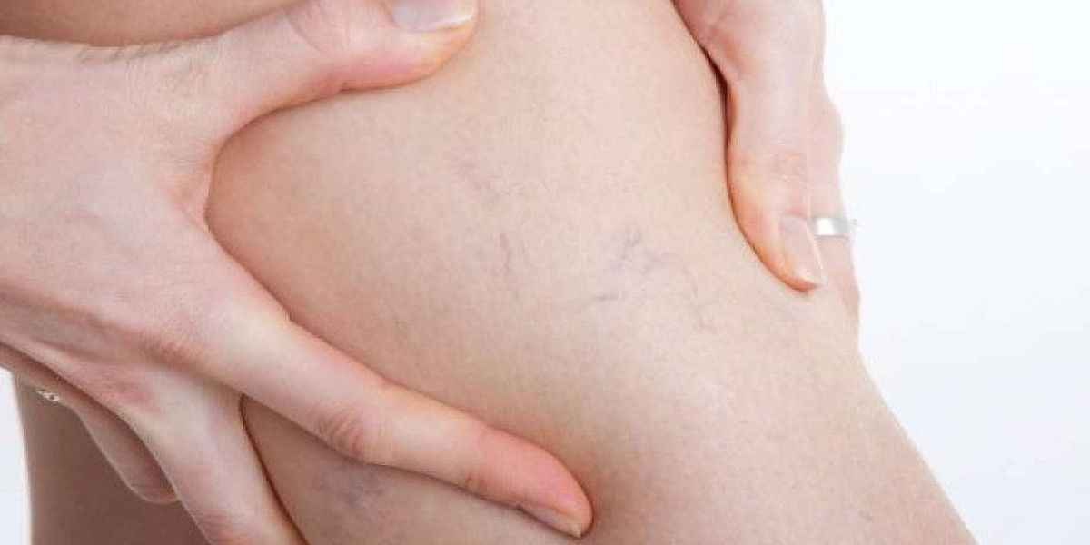 Venoxil est-il sans danger pour une utilisation quotidienne ?
