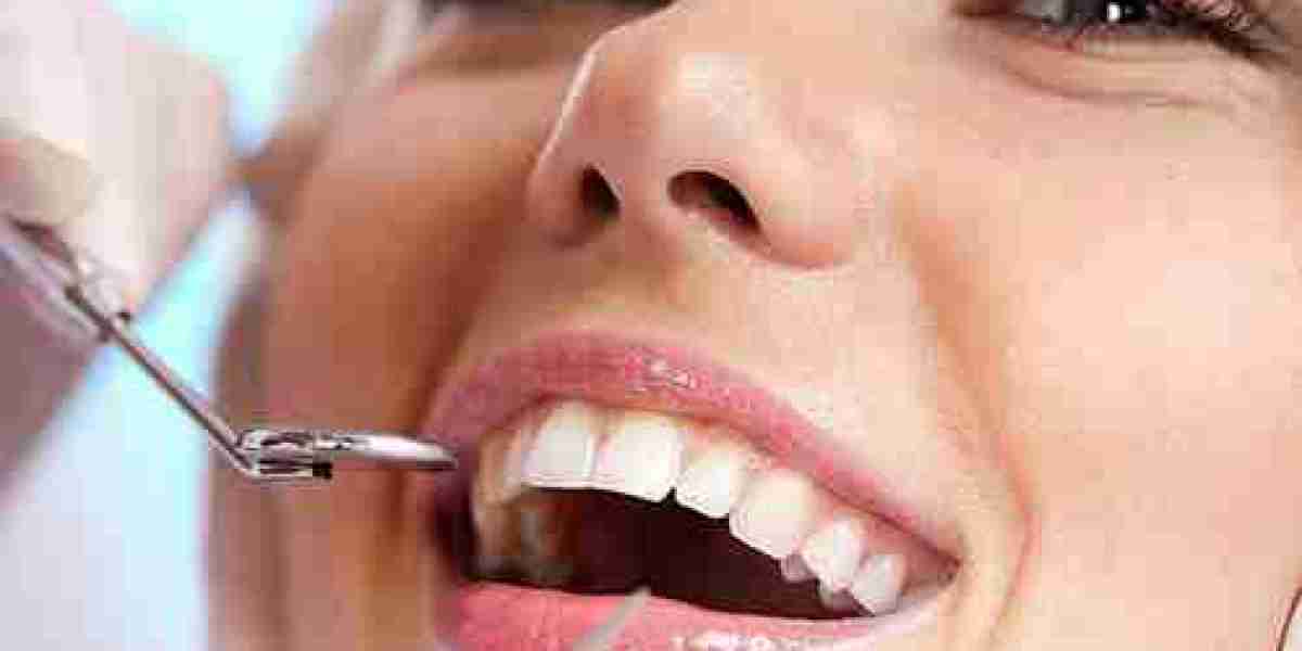 Fixed Dentures in Tampa: A Comprehensive Guide to Restoring Your Smile
