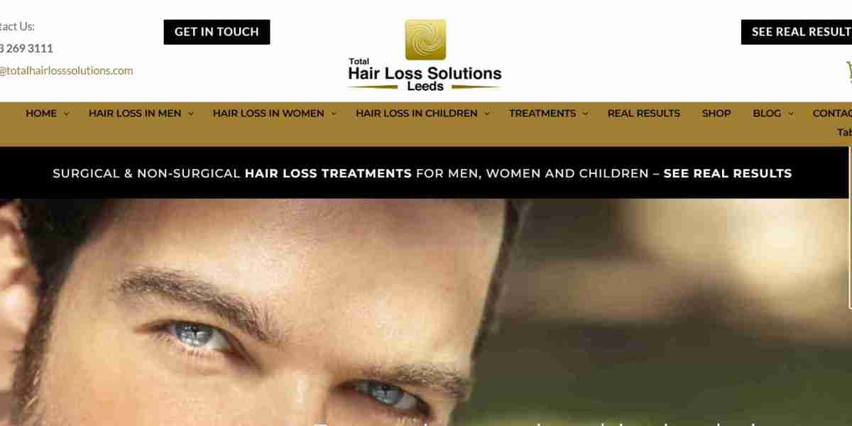 Male Hair Implants Clinic Near Me – Restoring Confidence with Advanced Hair Solutions