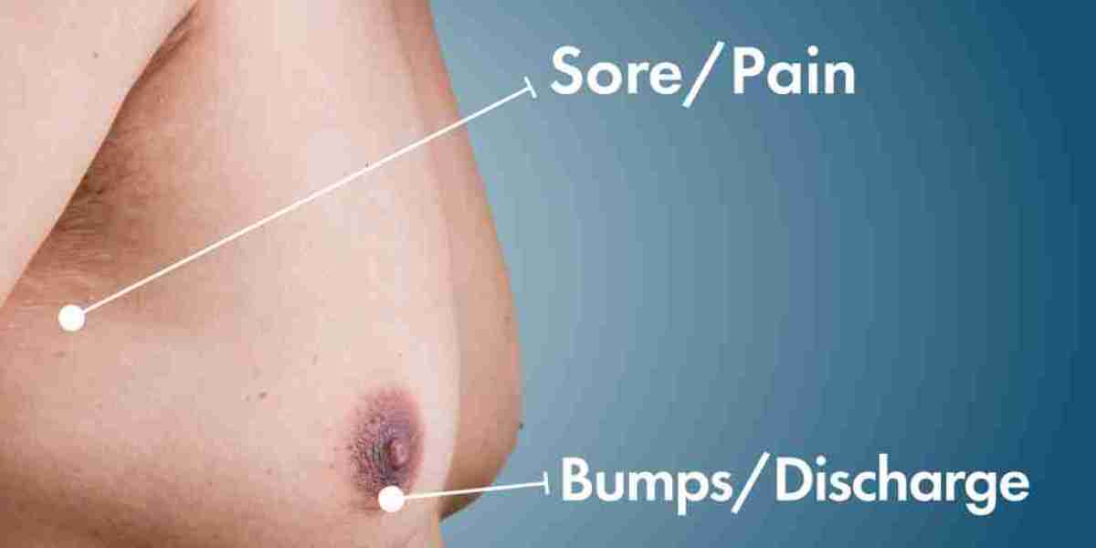 How to Choose the Right Surgeon for Gynecomastia in Islamabad