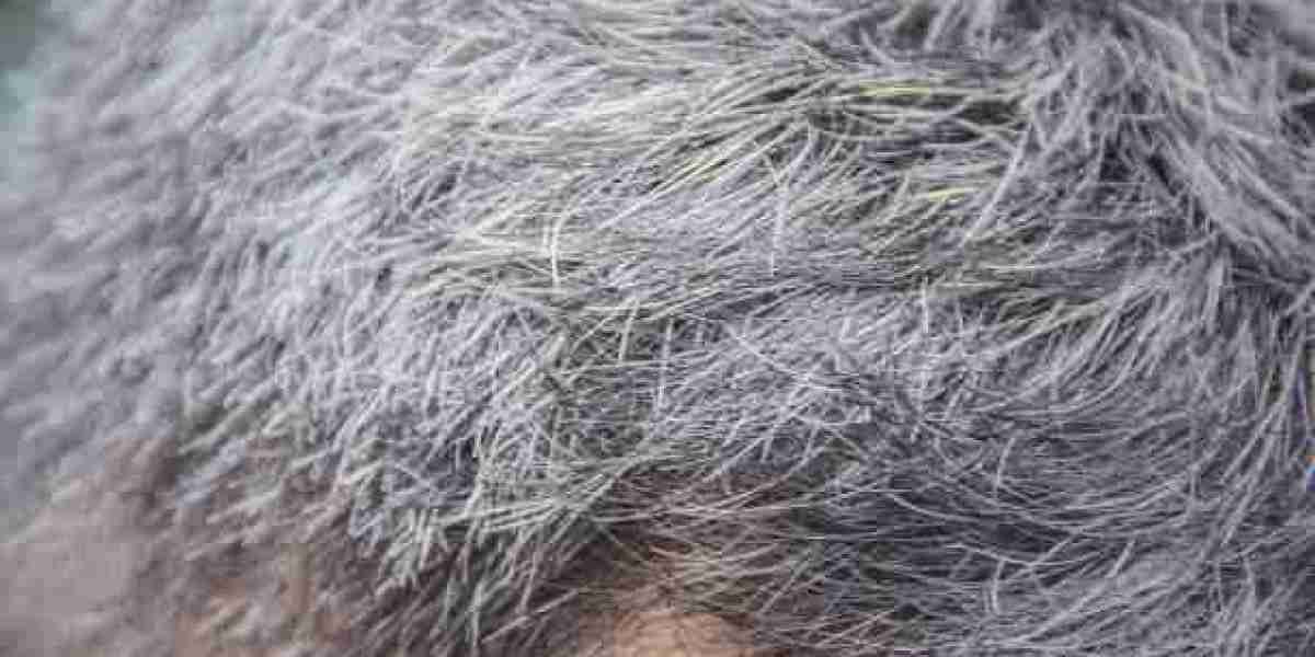 Amazing Hair dye for grey hair