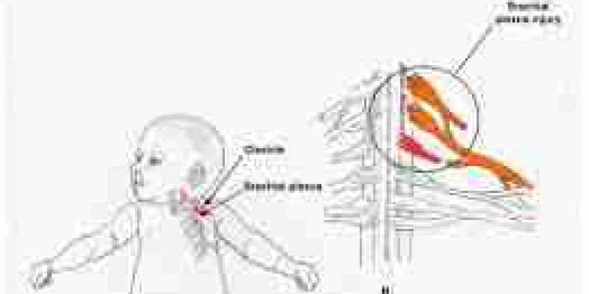 Brachial Plexus Birth Injury: Understanding Causes, Consequences, and Legal Options