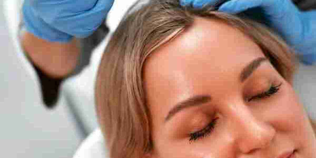 Best Age to Get PRP Treatment in Islamabad