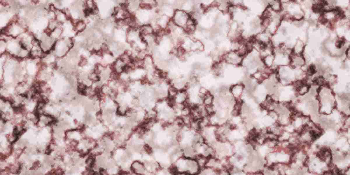 Exploring the Best Gold IRA Choices For Secure Retirement Investments