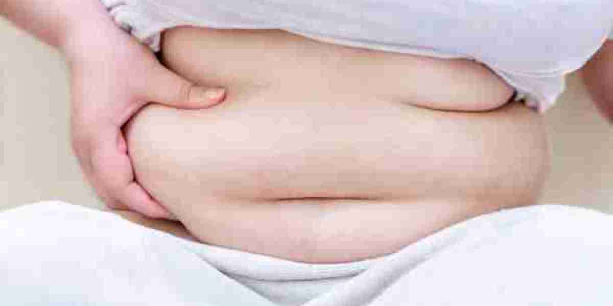 Extended Tummy Tuck Surgery Details Revealed