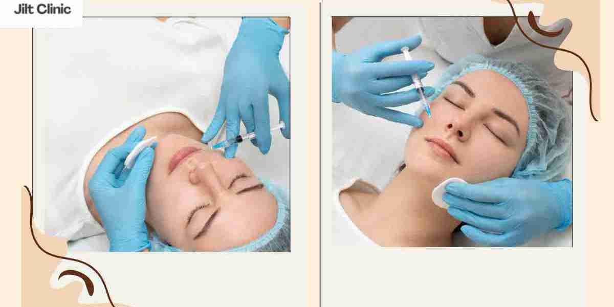 Marionettenfalten sanft behandeln für ein frisches Gesicht