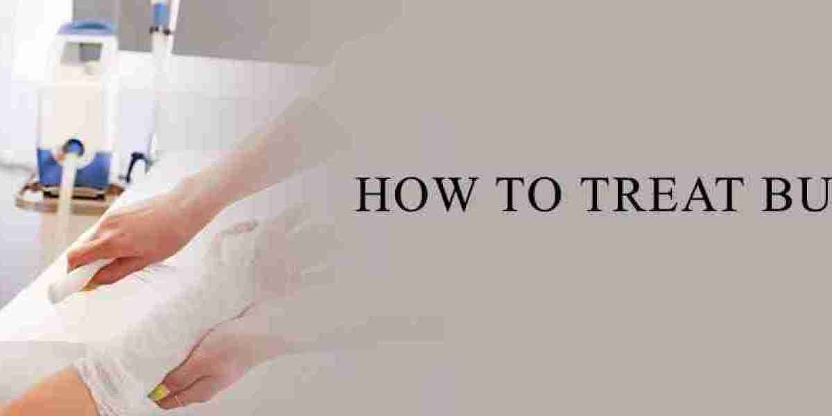 Expert Burn Treatment Solutions for Home and Clinic