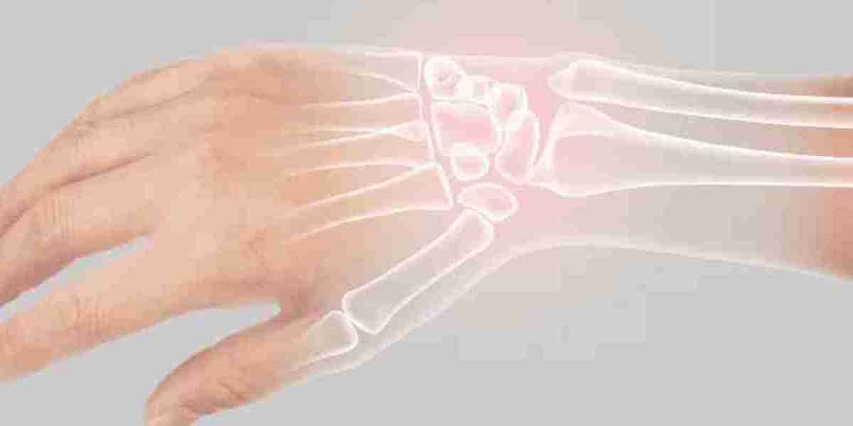 Carpal Tunnel Treatment in Mulund & Tendon Injury Care in Mumbai – Expert Orthopaedic Solutions at SportsOrtho