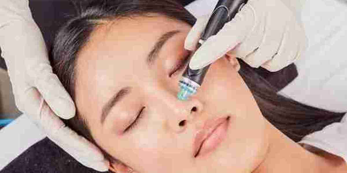 Hydrafacial Treatment as a Monthly Skincare Ritual That Works