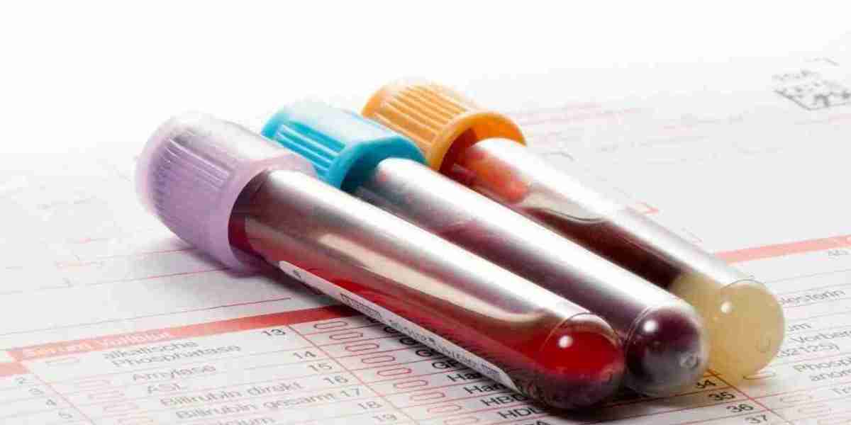 Full STD Panel vs Individual STD Tests: What’s the Difference?