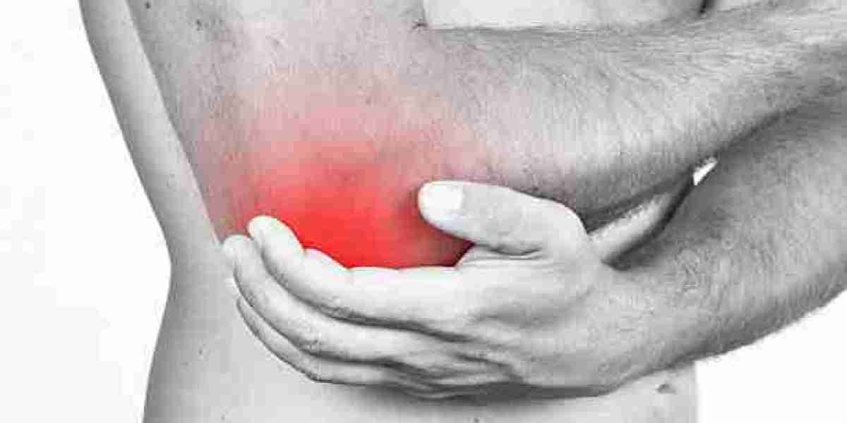 Fistula Surgery: Is It Right for You?