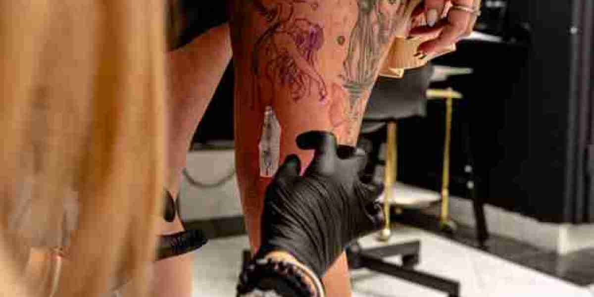 Can Laser Tattoo Removal Fade Scars?