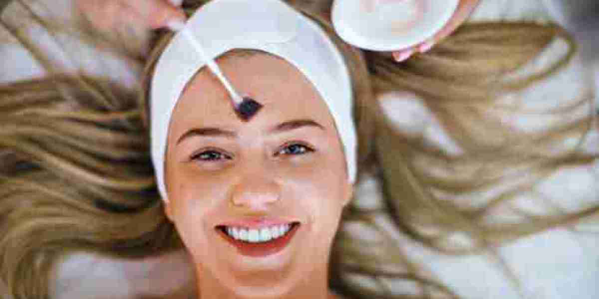 Chemical Peels Demystified: Mild, Medium, or Deep—Which Is Right for You?