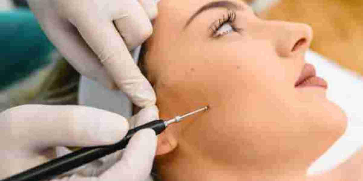 3D Imaging Tech in Modern Skin Tag Removal in Riyadh Procedures