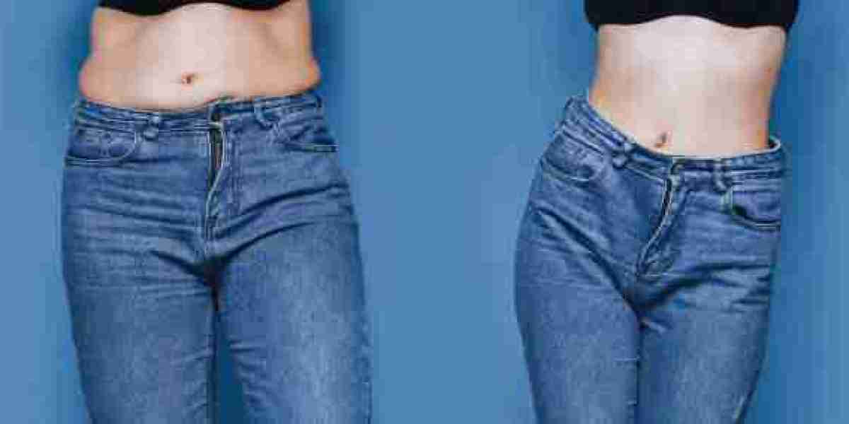 Boost Confidence with Tummy Tuck: Emotional Benefits