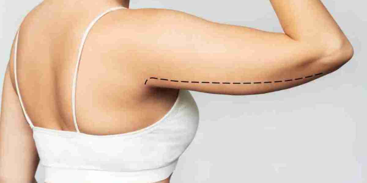 Is Arm Lift Surgery Worth It? Benefits, Risks, and Real Expectations