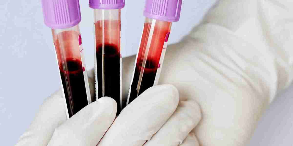 Candida Test for Yeast Infections: A Step-by-Step Guide