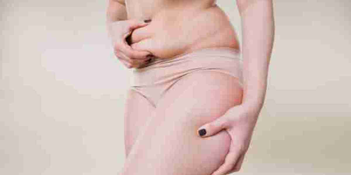 Tummy Tuck Surgery for Men: Sculpting a Stronger Core