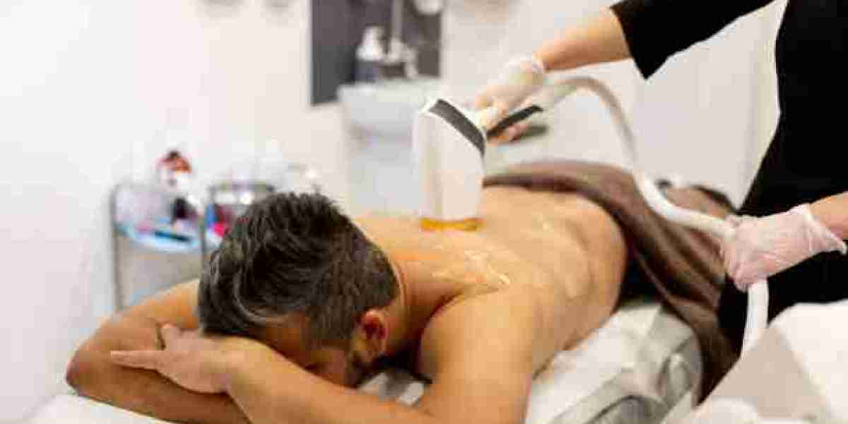 The Role of Technology in Personalizing Laser Hair Removal Treatments