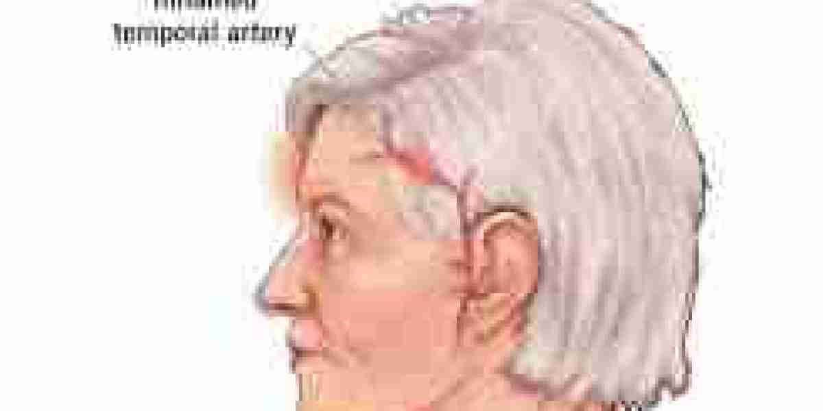 Giant Cell Arteritis Therapeutics Market: Emerging Biologics Driving Transformational Growth