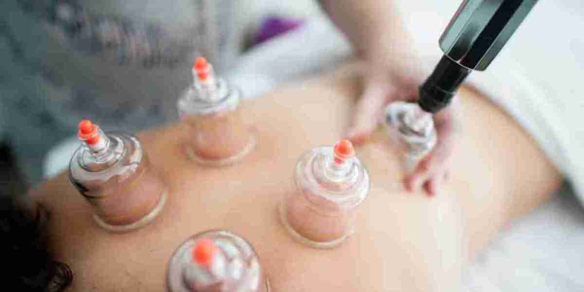 Hijama Cupping Therapy for Radiant Healthy Living