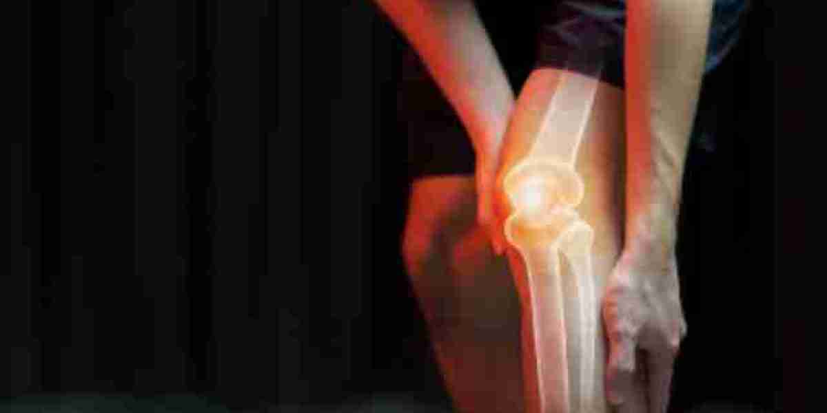 Veluflex – Soulagement efficace des douleurs [Veluflex Effets Secondaires] articulaires au quotidien