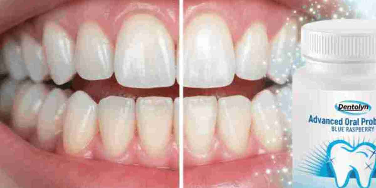 Dentolyn Capsules Supplement – Advanced Solution for Bad Breath, Strong Teeth & Daily Dental Hygiene