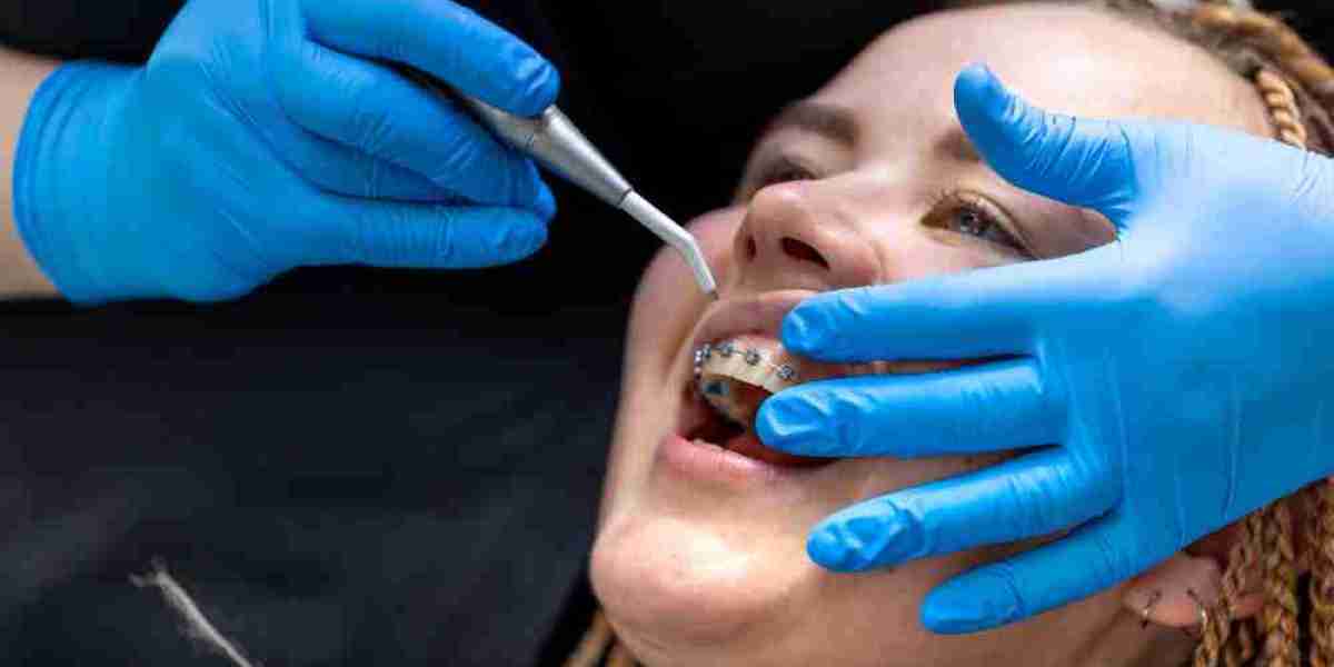 Dental Assistant Email List Connect with Dental Care Professionals