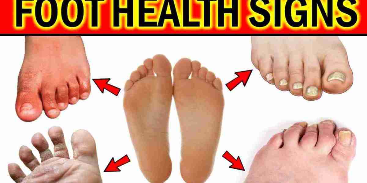Choosing the Right Podiatrist for Foot Health in Edinburgh