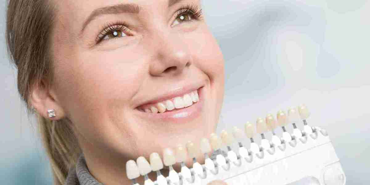 Dental Veneers for Missing Teeth: Are They Worth It?