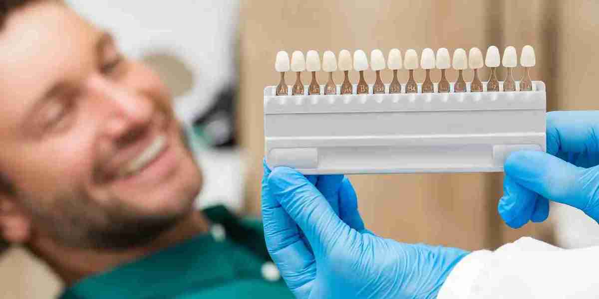 Transform Your Teeth Instantly Using Dental Veneers Cost