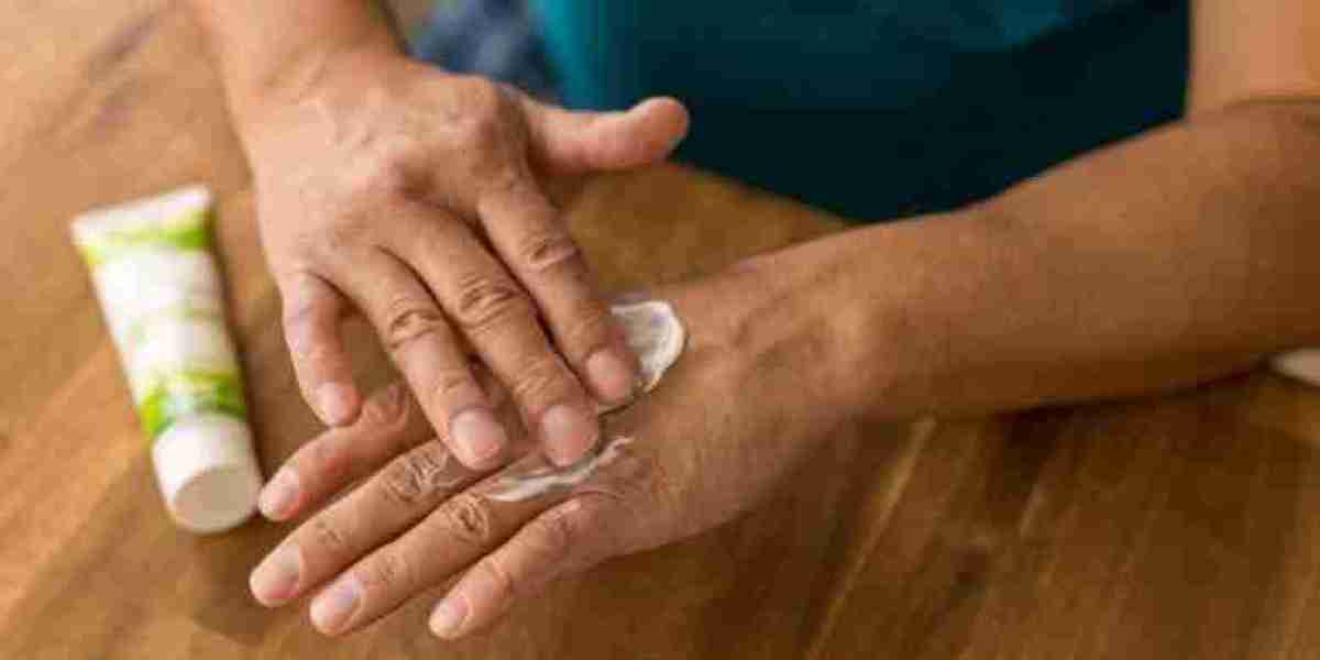Vitiligo Without Aggressive Therapies: Exploring Homeopathic Options