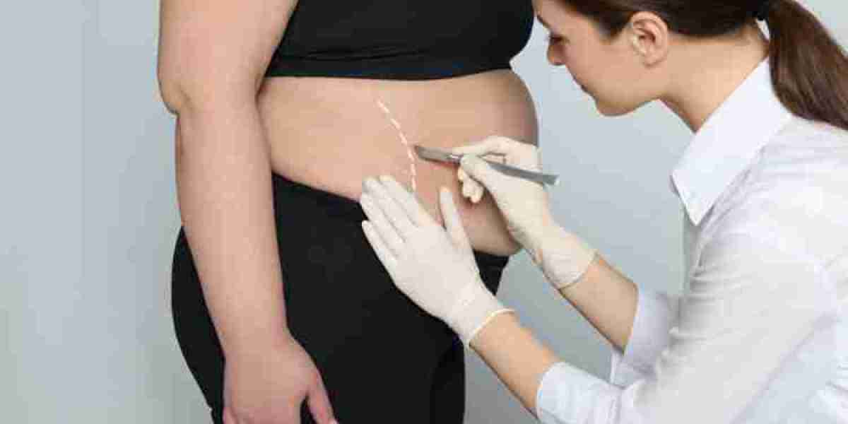 Unlock Your Transformation With Bariatric Surgery Cost Insights