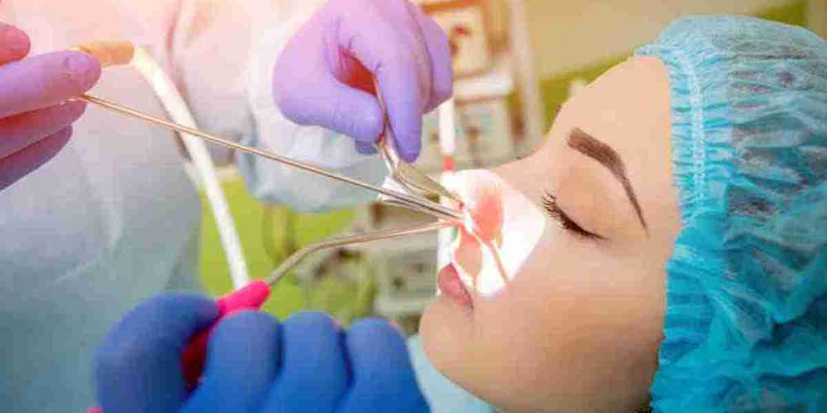 How to Choose the Right Nasal Polyps Treatment for Your Condition: A Complete Guide