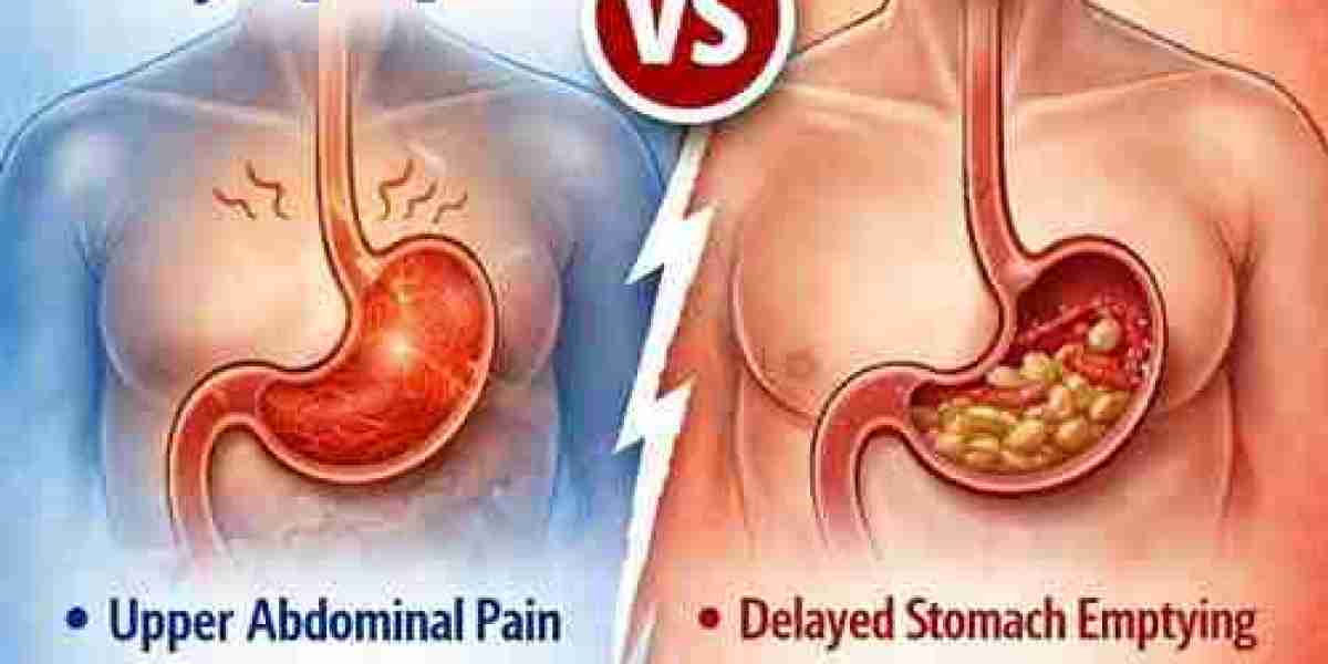 Functional Dyspepsia vs Gastroparesis