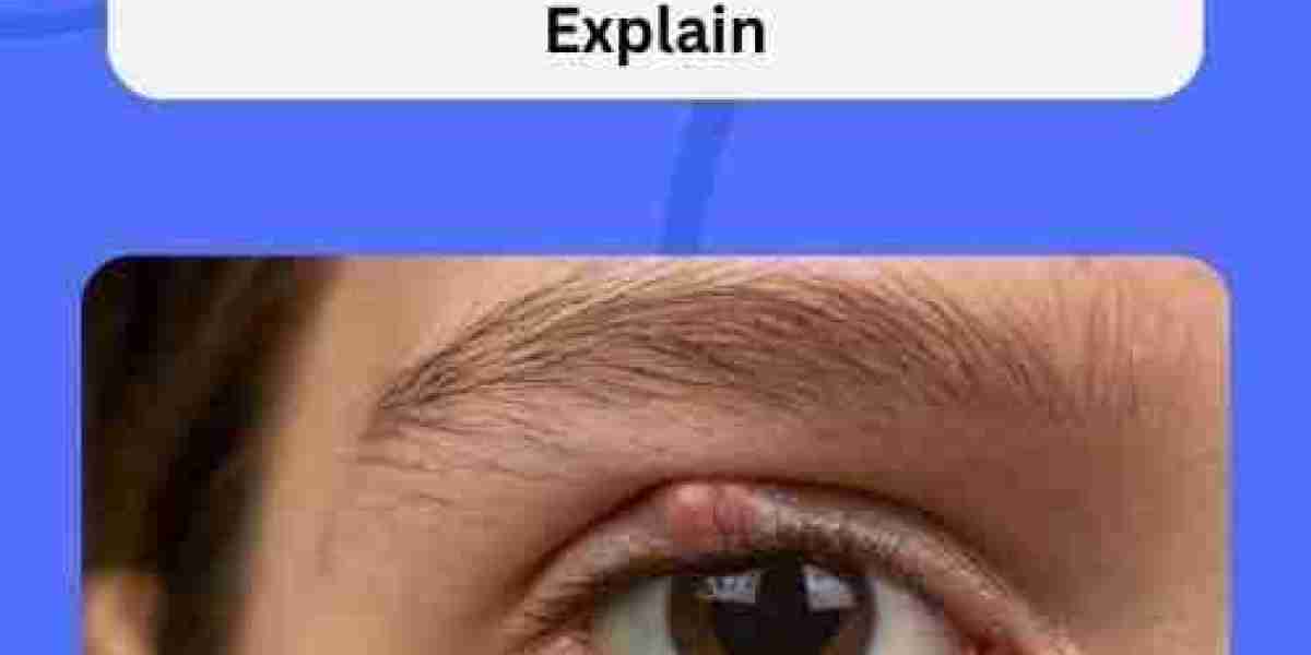 How Long Can Blepharitis Last — Days, Weeks, or Forever? Experts Explain