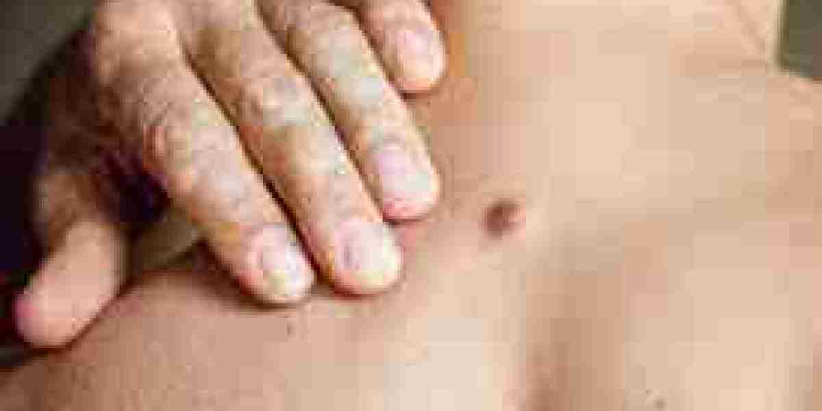 emergency infection relief flow Incision and Drainage of Abscesses