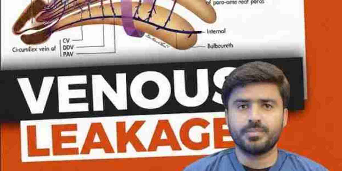 Venous Leak (Veno-Occlusive Dysfunction) Treatment