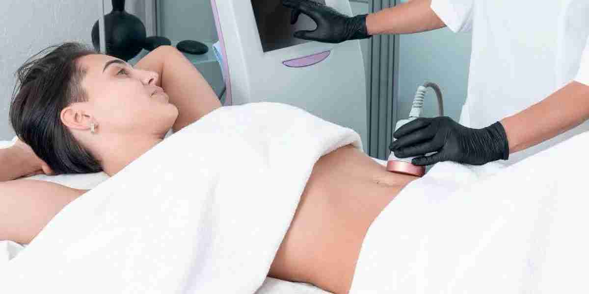 Laser Fat Reduction Results: What You Should Realistically Expect