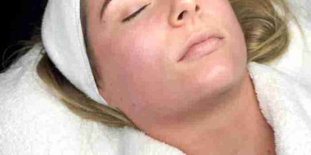 Biorepeel in Manchester: Revitalize Your Skin with a Powerful Peel