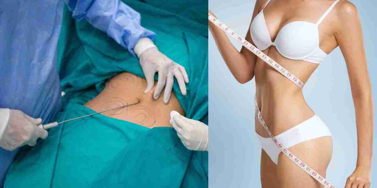 ابتكارات دبي في جراحة تنسيق القوام وشفط الدهون