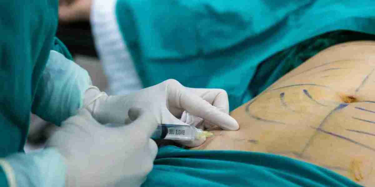 Liposuction in Islamabad: A Complete Beginner’s Guide to the Procedure, Cost, and Results