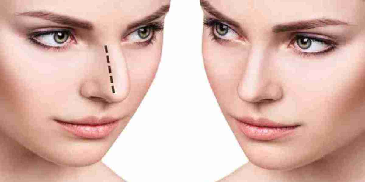 تجميل الأنف بدون جراحة في دبي: الحل السريع والمثالي