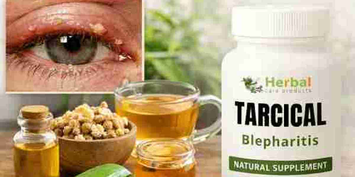 Natural Remedies for Blepharitis