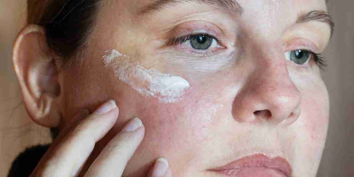 Melasma Treatment Solutions for Mature Skin